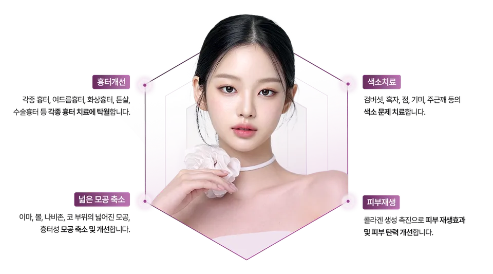 프락셀레이저 장점 이미지