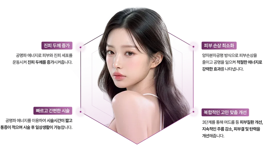 스마트 니들리프팅 장점 이미지